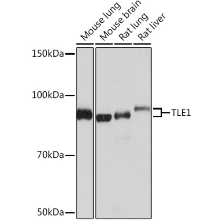 Western Blot - Anti-TLE 1 Antibody [ARC0793] (A306693) - Antibodies.com