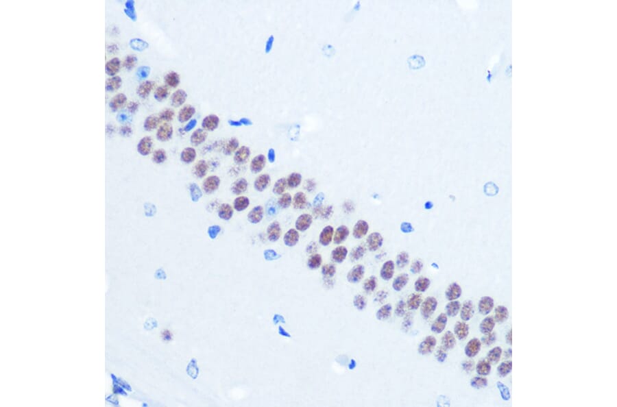 Immunohistochemistry - Anti-TLE 1 Antibody [ARC0793] (A306693) - Antibodies.com