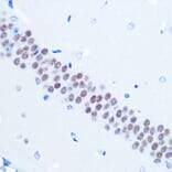 Immunohistochemistry - Anti-TLE 1 Antibody [ARC0793] (A306693) - Antibodies.com