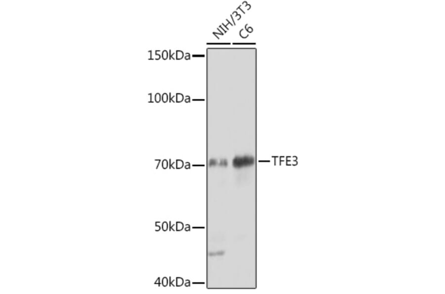 Western Blot - Anti-TFE3 Antibody [ARC1829] (A306694) - Antibodies.com
