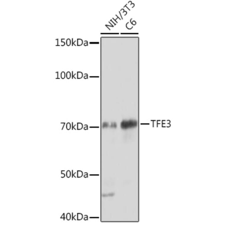 Western Blot - Anti-TFE3 Antibody [ARC1829] (A306694) - Antibodies.com