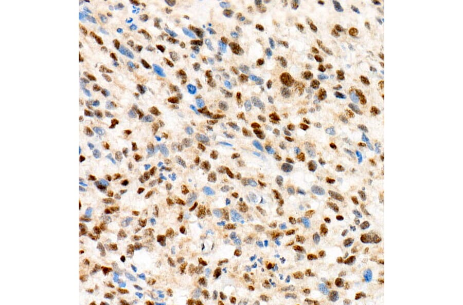 Immunohistochemistry - Anti-TFE3 Antibody [ARC1829] (A306694) - Antibodies.com