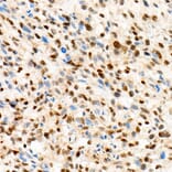 Immunohistochemistry - Anti-TFE3 Antibody [ARC1829] (A306694) - Antibodies.com