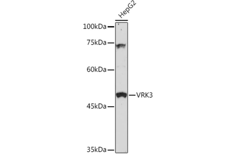 Western Blot - Anti-VRK3 Antibody (A306696) - Antibodies.com