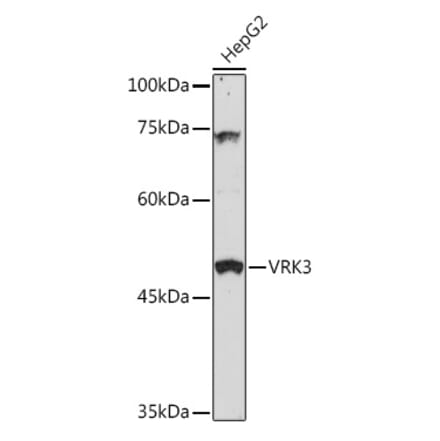 Western Blot - Anti-VRK3 Antibody (A306696) - Antibodies.com