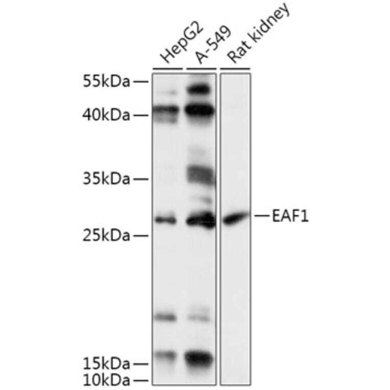 Western Blot - Anti-EAF1 Antibody (A306697) - Antibodies.com