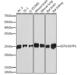 Western Blot - Anti-GST3 / GST pi Antibody [ARC0439] (A306698) - Antibodies.com