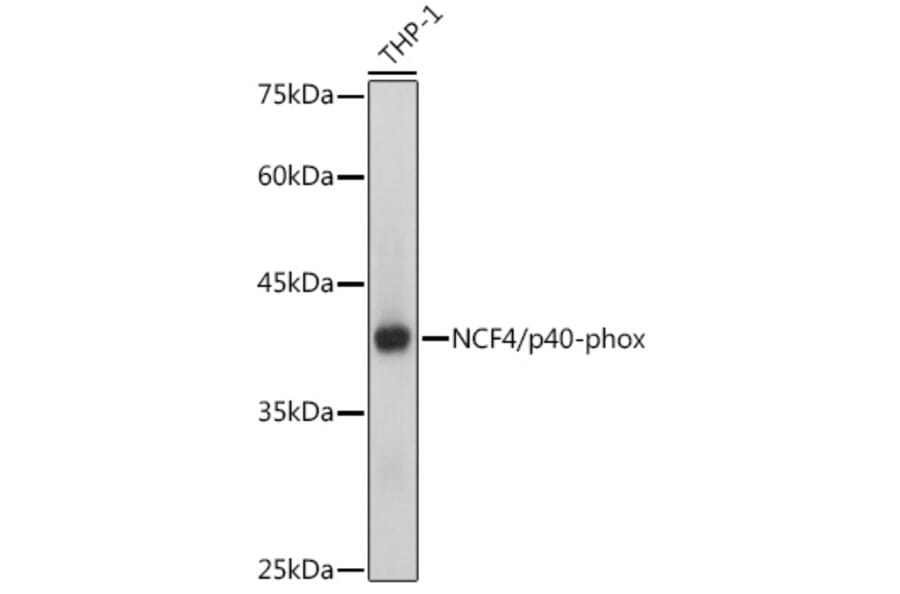 Western Blot - Anti-p40-phox Antibody [ARC2553] (A306699) - Antibodies.com