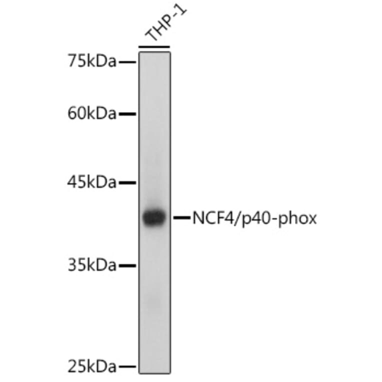 Western Blot - Anti-p40-phox Antibody [ARC2553] (A306699) - Antibodies.com