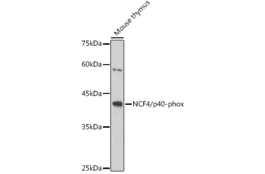 Western Blot - Anti-p40-phox Antibody [ARC2553] (A306699) - Antibodies.com
