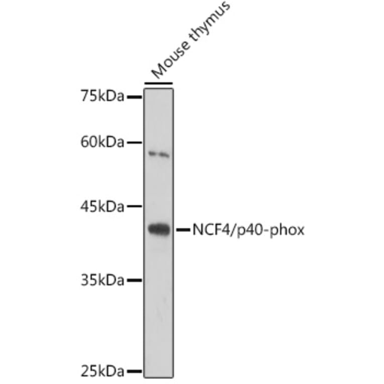 Western Blot - Anti-p40-phox Antibody [ARC2553] (A306699) - Antibodies.com