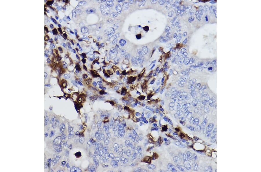 Immunohistochemistry - Anti-p40-phox Antibody [ARC2553] (A306699) - Antibodies.com