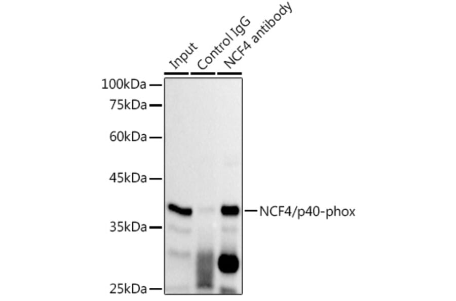 Western Blot - Anti-p40-phox Antibody [ARC2553] (A306699) - Antibodies.com