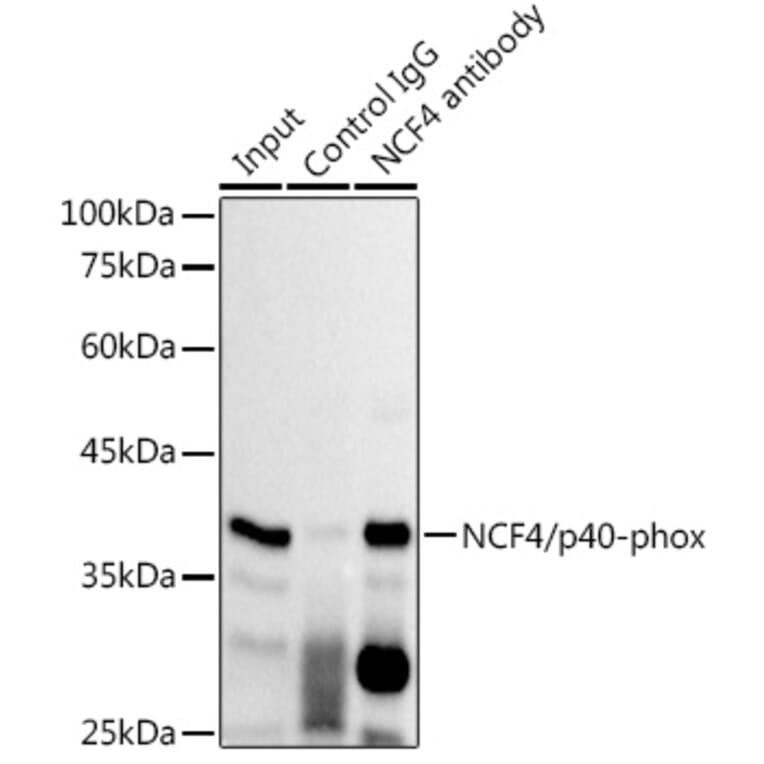 Western Blot - Anti-p40-phox Antibody [ARC2553] (A306699) - Antibodies.com