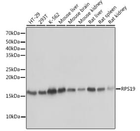 Western Blot - Anti-RPS19 Antibody [ARC0820] (A306700) - Antibodies.com