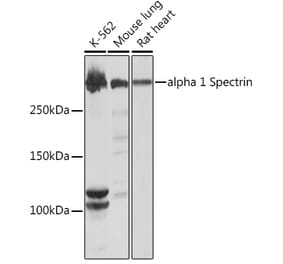 Western Blot - Anti-alpha 1 Spectrin Antibody [ARC1650] (A306701) - Antibodies.com