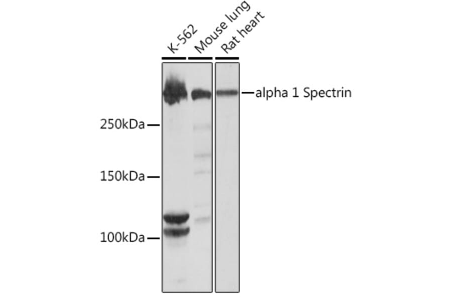 Western Blot - Anti-alpha 1 Spectrin Antibody [ARC1650] (A306701) - Antibodies.com