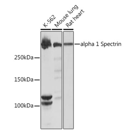 Western Blot - Anti-alpha 1 Spectrin Antibody [ARC1650] (A306701) - Antibodies.com