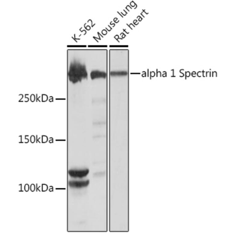 Western Blot - Anti-alpha 1 Spectrin Antibody [ARC1650] (A306701) - Antibodies.com