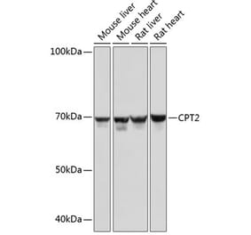 Western Blot - Anti-CPT2 Antibody [ARC0516] (A306702) - Antibodies.com