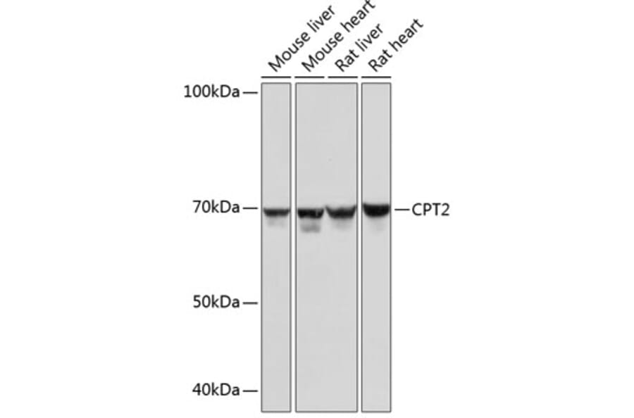 Western Blot - Anti-CPT2 Antibody [ARC0516] (A306702) - Antibodies.com