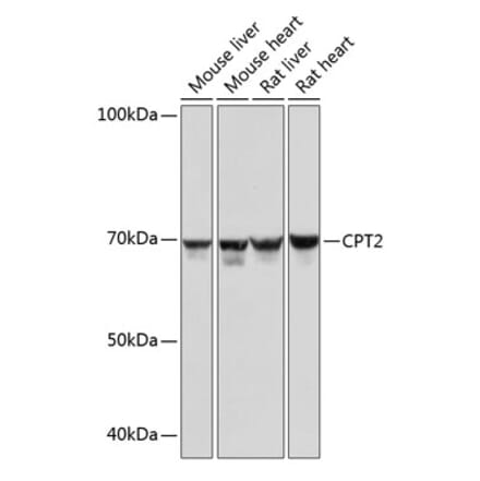 Western Blot - Anti-CPT2 Antibody [ARC0516] (A306702) - Antibodies.com