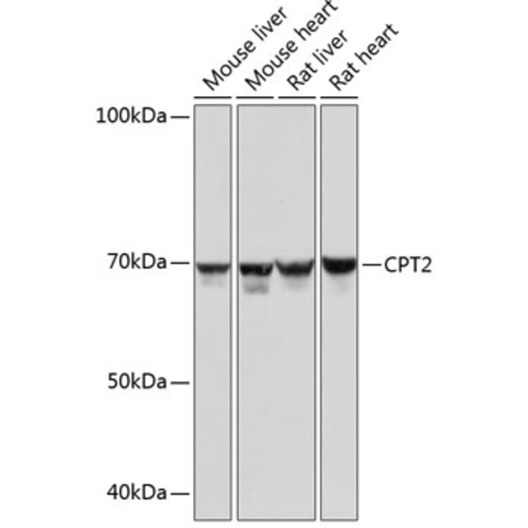 Western Blot - Anti-CPT2 Antibody [ARC0516] (A306702) - Antibodies.com