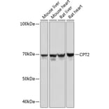 Western Blot - Anti-CPT2 Antibody [ARC0516] (A306702) - Antibodies.com