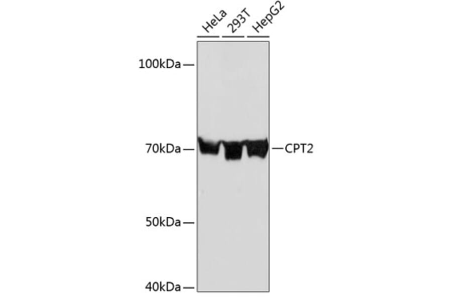 Western Blot - Anti-CPT2 Antibody [ARC0516] (A306702) - Antibodies.com