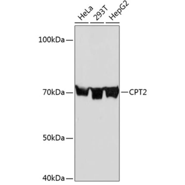 Western Blot - Anti-CPT2 Antibody [ARC0516] (A306702) - Antibodies.com