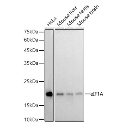 Western Blot - Anti-eIF1A Antibody [ARC2941] (A306703) - Antibodies.com