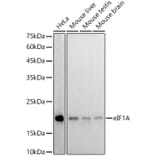 Western Blot - Anti-eIF1A Antibody [ARC2941] (A306703) - Antibodies.com