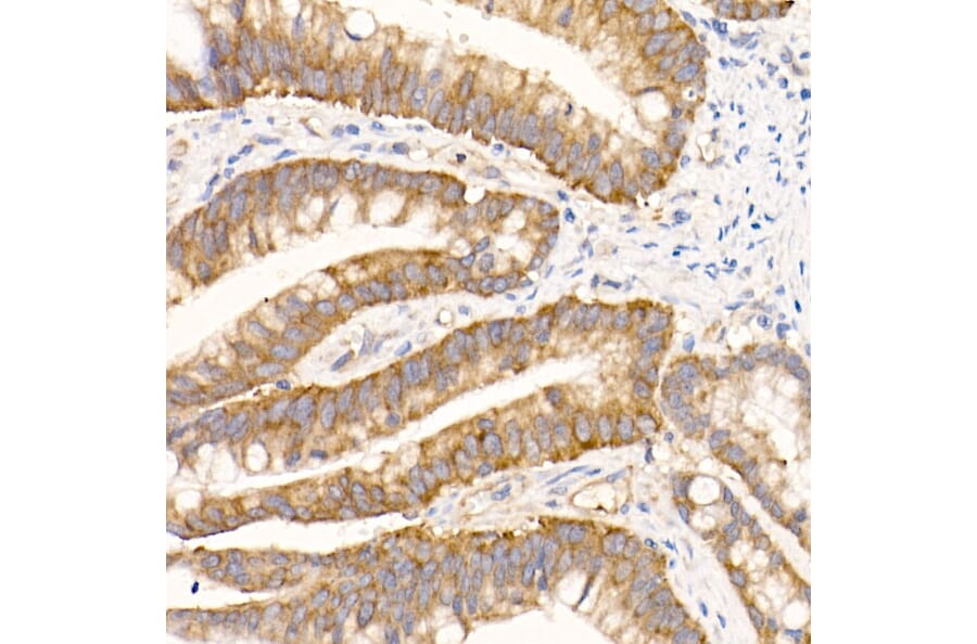 Immunohistochemistry - Anti-eIF1A Antibody [ARC2941] (A306703) - Antibodies.com