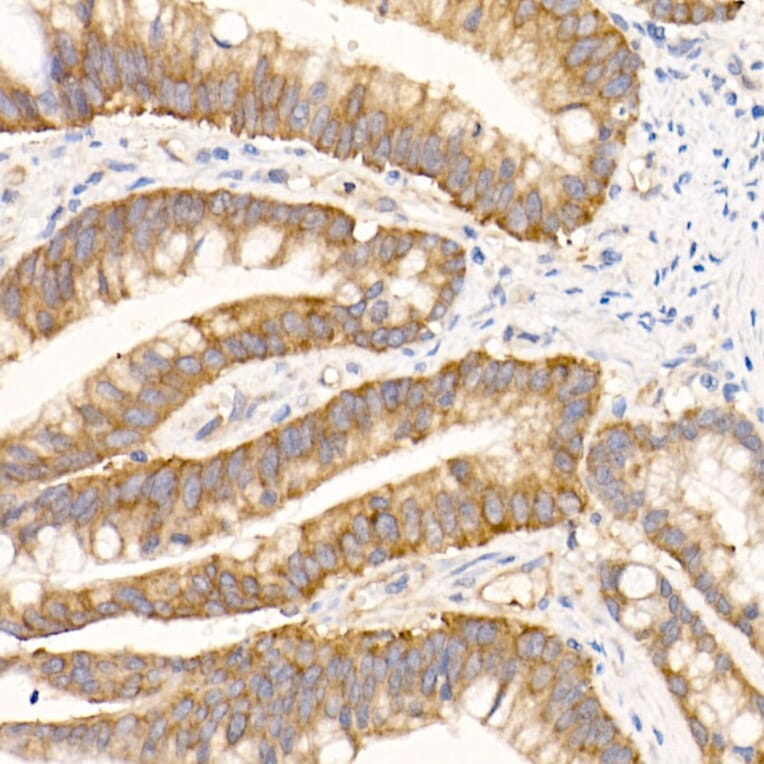 Immunohistochemistry - Anti-eIF1A Antibody [ARC2941] (A306703) - Antibodies.com