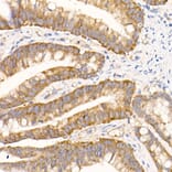 Immunohistochemistry - Anti-eIF1A Antibody [ARC2941] (A306703) - Antibodies.com