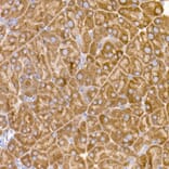 Immunohistochemistry - Anti-eIF1A Antibody [ARC2941] (A306703) - Antibodies.com