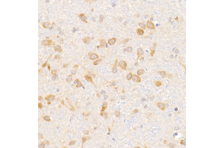 Immunohistochemistry - Anti-eIF1A Antibody [ARC2941] (A306703) - Antibodies.com