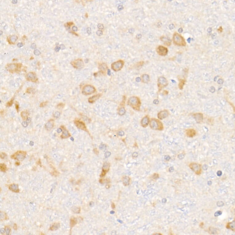 Immunohistochemistry - Anti-eIF1A Antibody [ARC2941] (A306703) - Antibodies.com