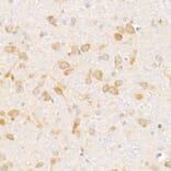 Immunohistochemistry - Anti-eIF1A Antibody [ARC2941] (A306703) - Antibodies.com
