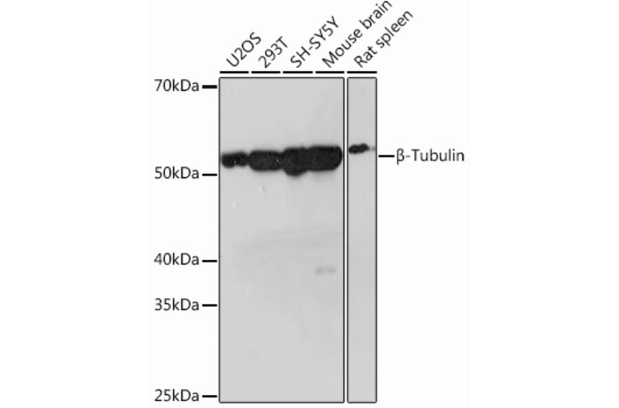 Western Blot - Anti-beta Tubulin Antibody [ARC0203] (A306704) - Antibodies.com