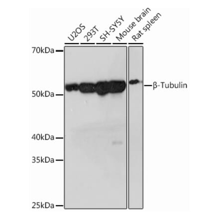 Western Blot - Anti-beta Tubulin Antibody [ARC0203] (A306704) - Antibodies.com