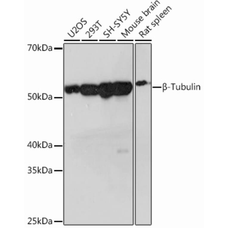 Western Blot - Anti-beta Tubulin Antibody [ARC0203] (A306704) - Antibodies.com