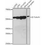 Western Blot - Anti-beta Tubulin Antibody [ARC0203] (A306704) - Antibodies.com