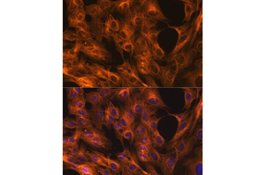 Immunofluorescence - Anti-beta Tubulin Antibody [ARC0203] (A306704) - Antibodies.com