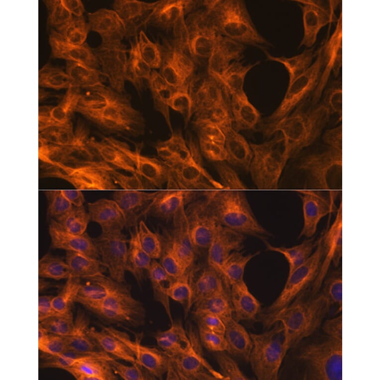 Immunofluorescence - Anti-beta Tubulin Antibody [ARC0203] (A306704) - Antibodies.com