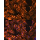 Immunofluorescence - Anti-beta Tubulin Antibody [ARC0203] (A306704) - Antibodies.com