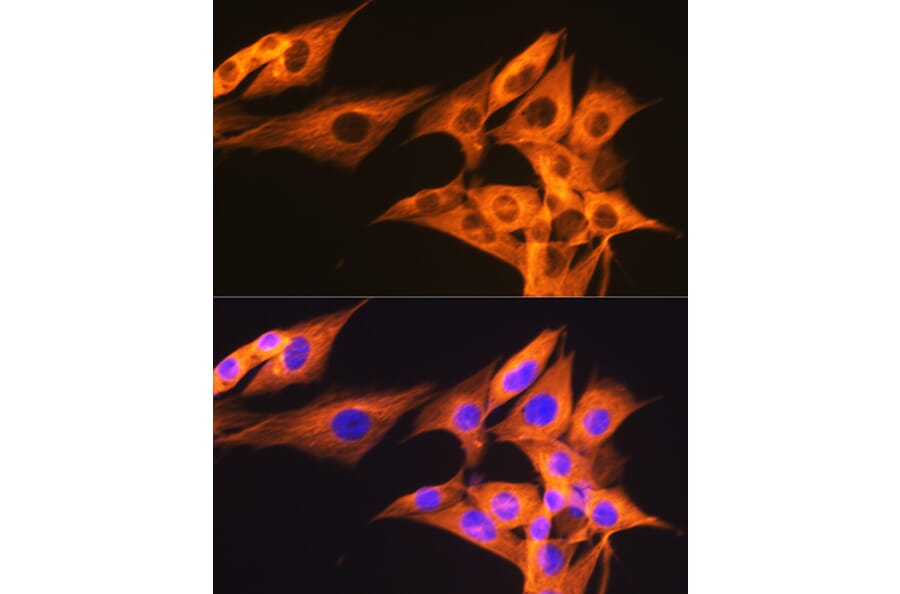 Immunofluorescence - Anti-beta Tubulin Antibody [ARC0203] (A306704) - Antibodies.com