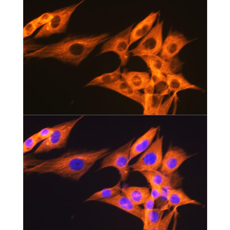 Immunofluorescence - Anti-beta Tubulin Antibody [ARC0203] (A306704) - Antibodies.com