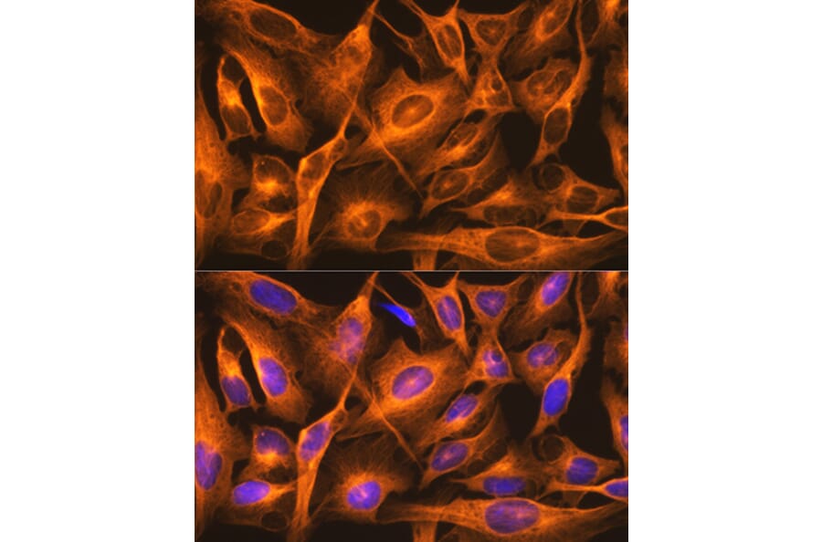 Immunofluorescence - Anti-beta Tubulin Antibody [ARC0203] (A306704) - Antibodies.com