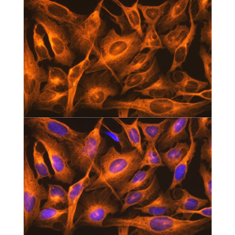 Immunofluorescence - Anti-beta Tubulin Antibody [ARC0203] (A306704) - Antibodies.com